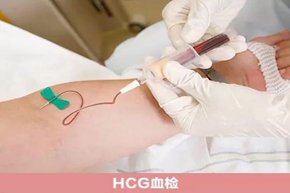 第三方供卵试管代怀_第三方供卵试管代怀:辅助生殖技术的新希望