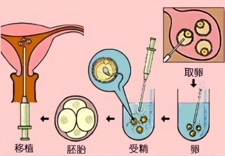 供卵生的孩子是自己的吗(供卵生的孩子是自己的吗?真相揭秘)